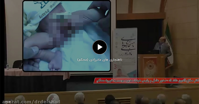 عمل ناهنجاری مادرزادی