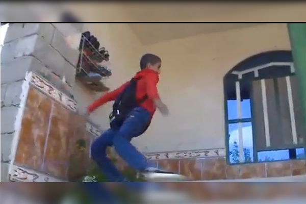 زانوی به عقب برگشته